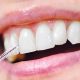 scovolino-denti-parodontite-dentista-a-varese